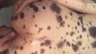Vitiligo porn